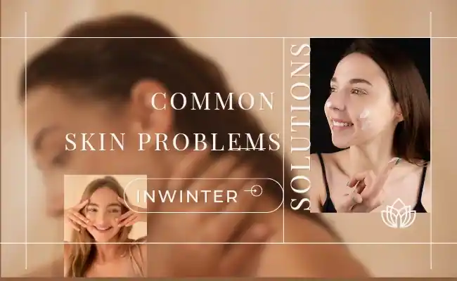 common skin problems in winter